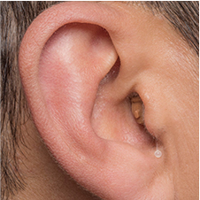 ear aid inside the ear